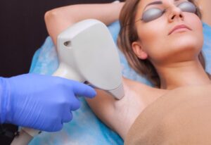 woman-having-laser-hair-removal-on-her-armpit